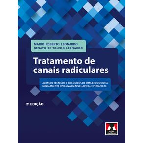 Tratamento-de-canais-radiculares