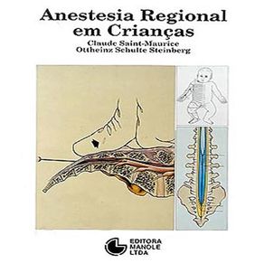 Anestesia-regional-em-criancas