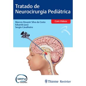 Tratado-de-neurocirurgia-pediatrica