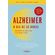 Alzheimer-o-dia-de-36-horas-cuidando-de-quem-tem-e-de-quem-cuida
