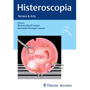 Histeroscopia-tecnica---arte