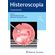 Histeroscopia-tecnica---arte
