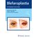 Blefaroplastia-em-realidade-aumentada