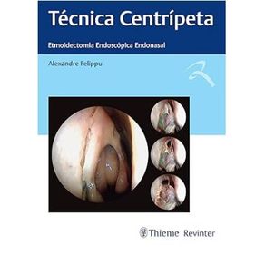 Tecnica-centripeta-etmoidectomia-endoscopica-endonasal