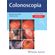 Colonoscopia