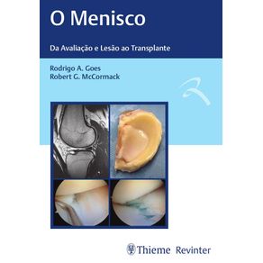 O-menisco-da-avaliacao-e-lesao-ao-transplante