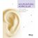 Acupuntura-auricular