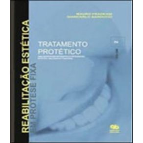 Reabilitacao-estetica-em-protese-fixa